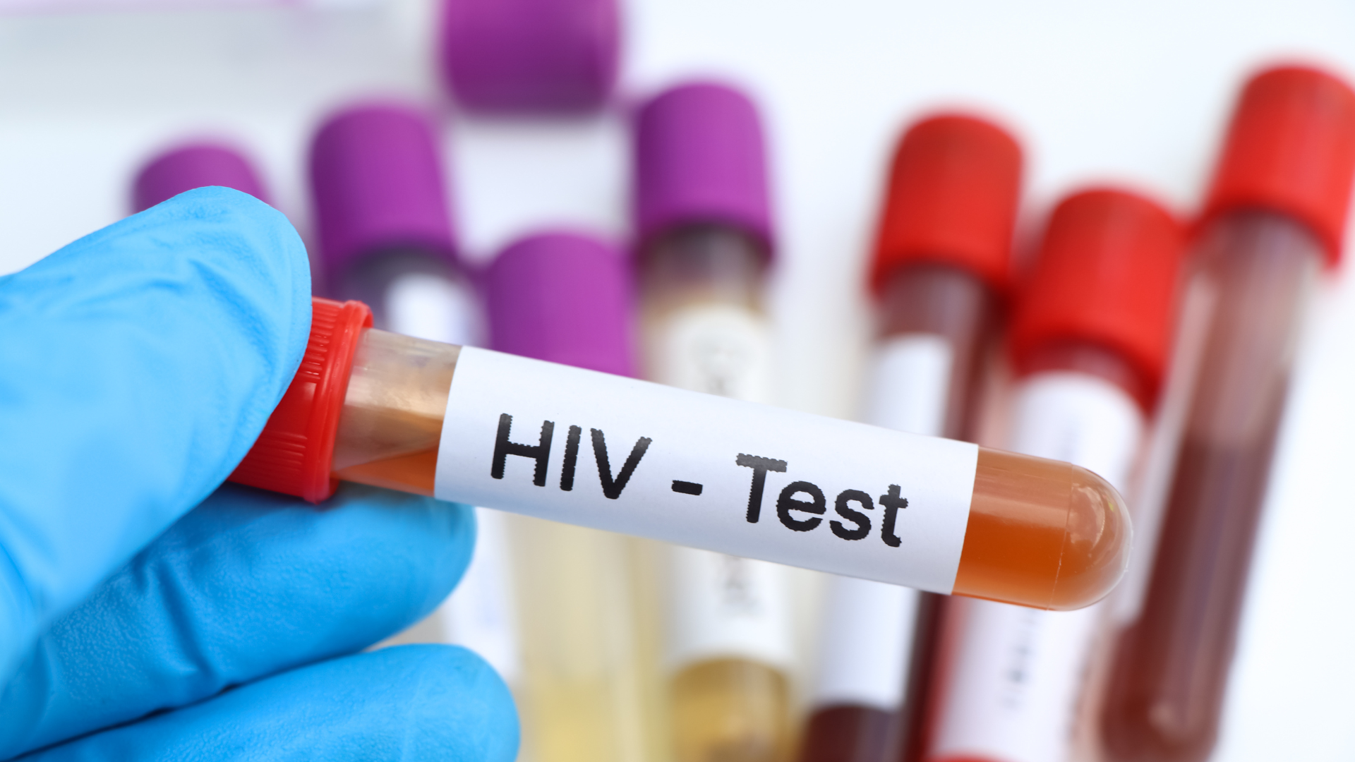 Hướng dẫn tự test HIV tại nhà bằng que test và thời điểm chính xác